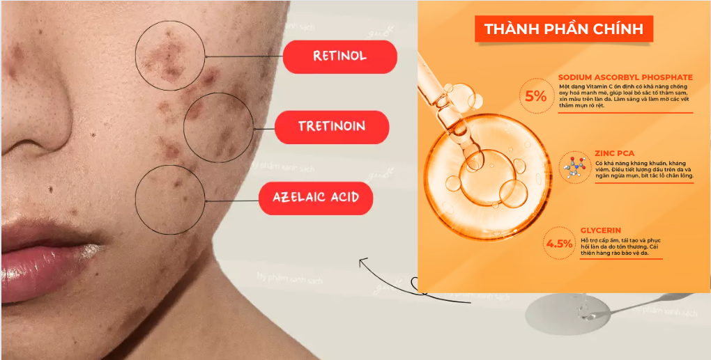 Bí Quyết Chọn Serum Mờ Thâm Hiệu Quả Giúp Làn Da Sáng Mịn Tự Nhiên-747-1