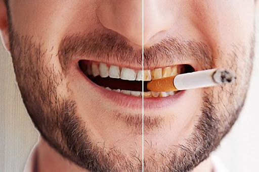 Tác Hại Khôn Lường Của Thuốc Lá Đối Với Sức Khỏe Của Bạn-789-1