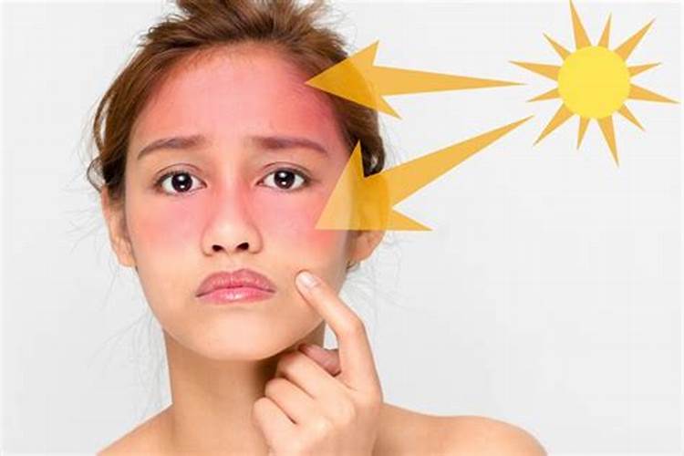 Kem Chống Nắng Không Gây Kích Ứng: Bảo Vệ Da Hiệu Quả Và An Toàn