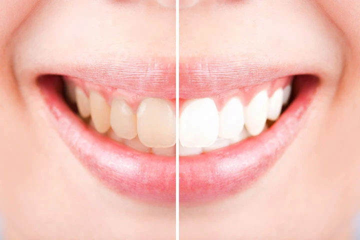 Kem Đánh Răng Trắng Sáng Hương Trà Xanh Darlie Thái Lan Chính Hãng